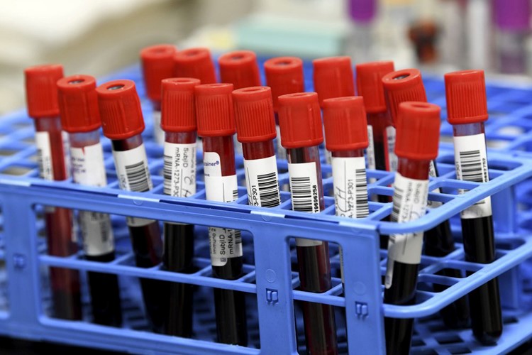 Mẫu máu của tình nguyện vên trong giai đoạn thử nghiệm cuối vaccine COVID-19 của Moderna. Ảnh: AP