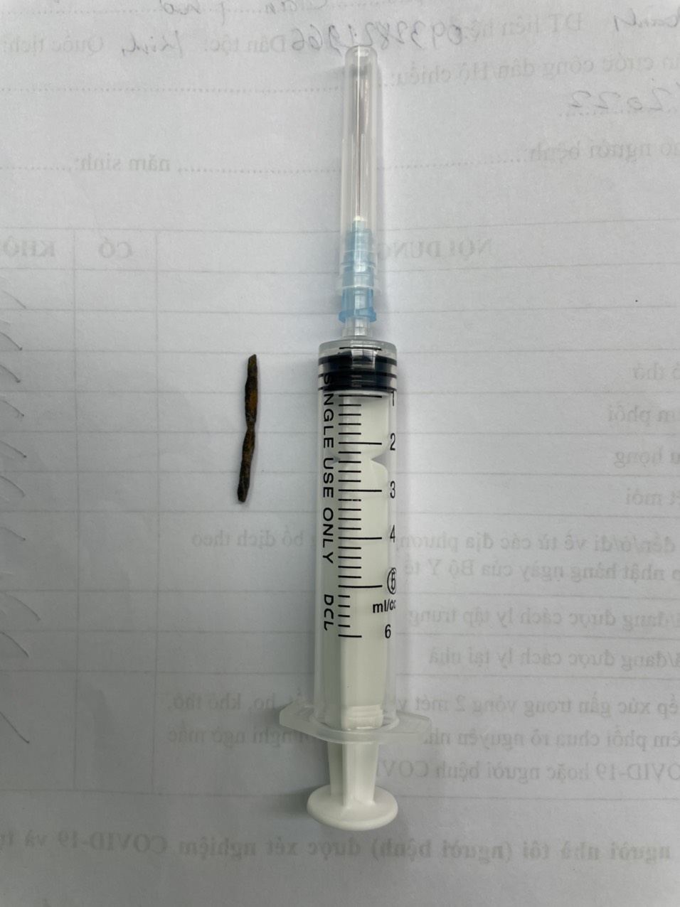 Đoạn kim loại dài 4 x 0,4cm được lấy ra từ buồng tim của BN.